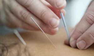 湖州哪里有中医师承培训？